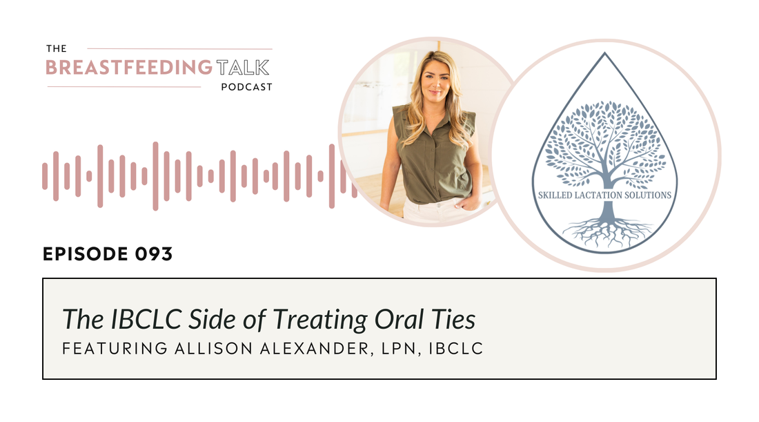 The IBCLC Side of Treating Oral Ties